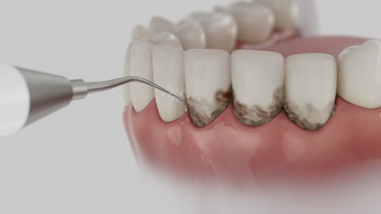 Trusted Dental Implants service in Norwalk, OH - Dentist Open Now